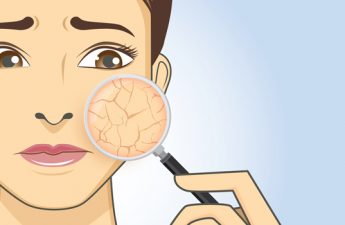 اینفوگرافیک: ۱۰ عاملی که باعث خشکی پوست می‌شوند را بشناسیم