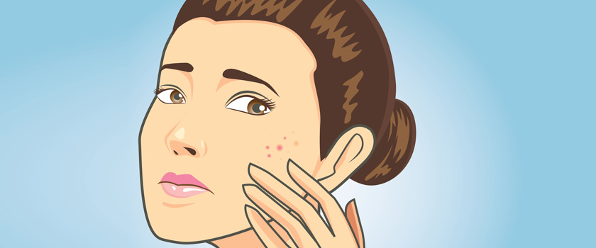 اینفوگرافیک: ۶ روش موثر برای درمان جوش صورت