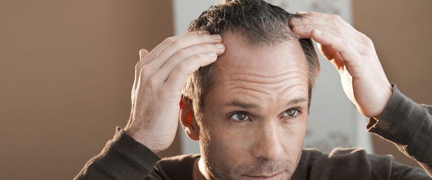 درمان ریزش مو و روش‌هایی که برای درمان ضروری است