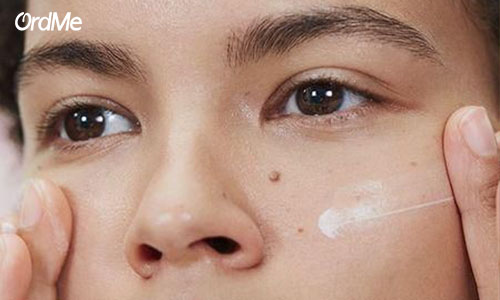 برای درمان لک روی پوست بهتر است از کرم ضد لک عالی استفاده کنید.