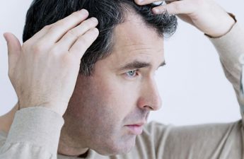 راه های درمان ریزش مو : با این روش‌ها ریزش مو را متوقف کنید.
