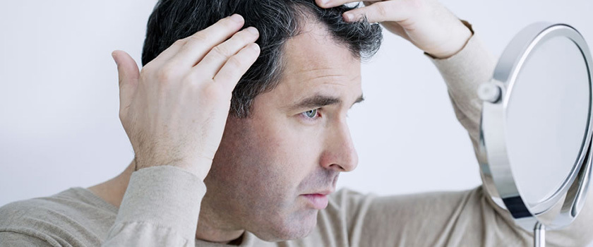 راه های درمان ریزش مو : با این روش‌ها ریزش مو را متوقف کنید.