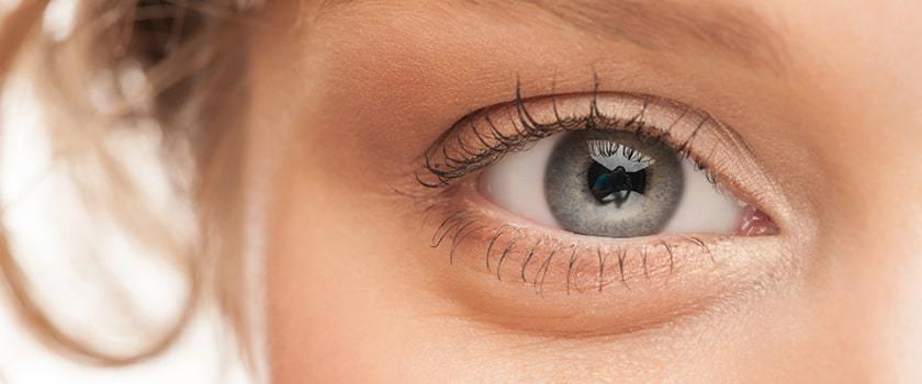 راه های درمان پف زیر چشم: خرید بهترین کرم دور چشم یا جراحی؟