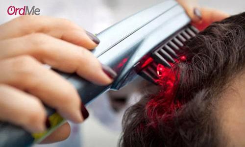 لیزر درمانی برای درمان ریزش مو