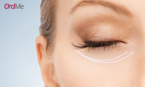 روش های درمان سیاهی زیر چشم