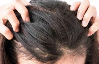 استفاده از ماینوکسیدیل چه تاثیری بر درمان ریزش مو دارد؟