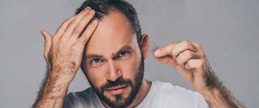 الگوی طاسی مردانه و زنانه | بررسی دلایل اصلی ریزش مو