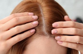 ریزش موی زنان | بررسی علت و راه های درمان آن