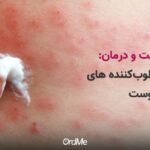 اگزما پوستی چیست؟ بهترین راه درمان دارویی و خانگی + 7 محصول مراقبت پوستی اگزما