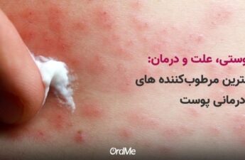 اگزما پوستی چیست؟ بهترین راه درمان دارویی و خانگی + 7 محصول مراقبت پوستی اگزما