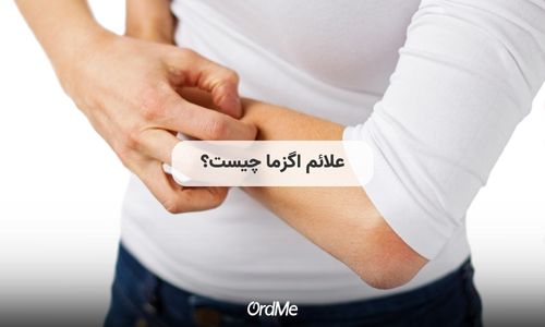 علائم اگزما چیست