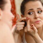 بهترین کرم ضد جوش و جای جوش